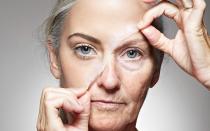 Резкое старение кожи: с чем это связано и как бороться